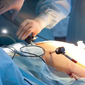Gynaecologic Laparoscopic Surgery