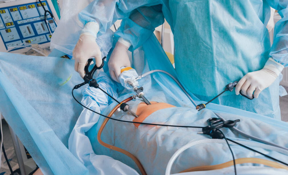 Laparoscopic Surgery