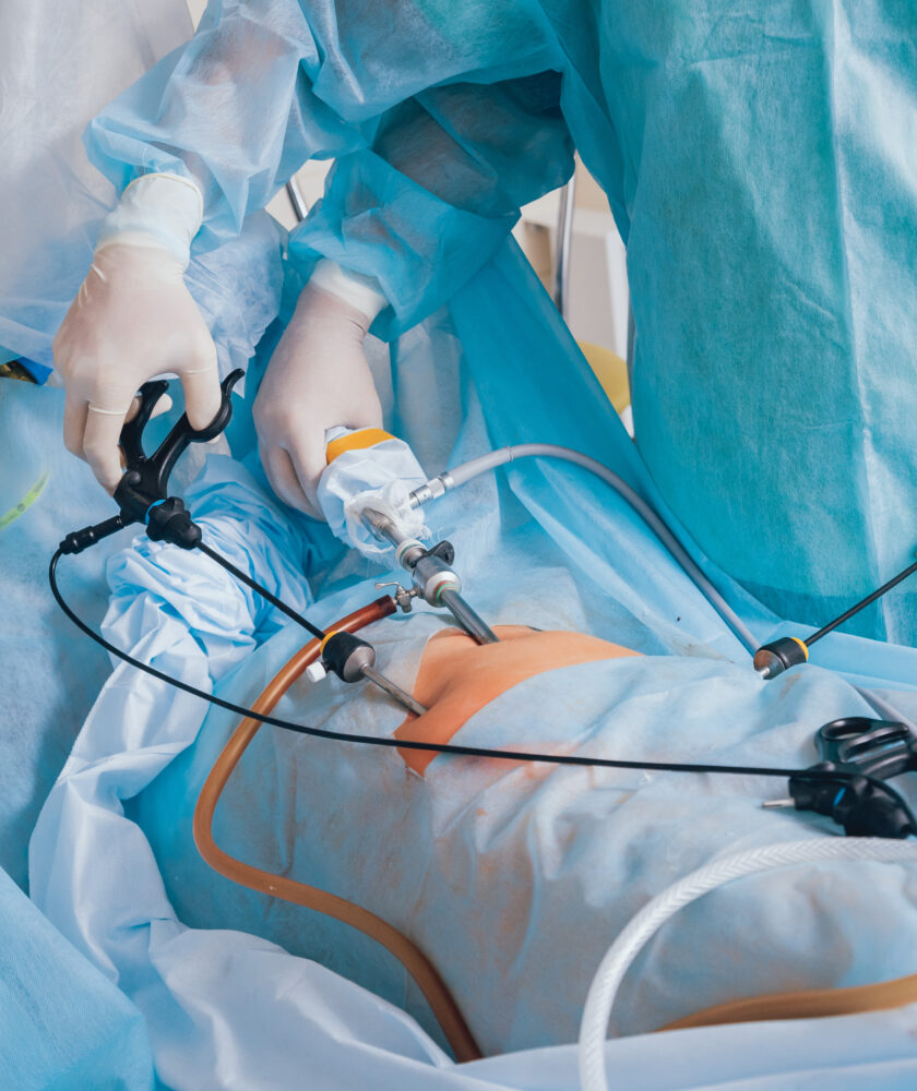 Laparoscopic Surgery