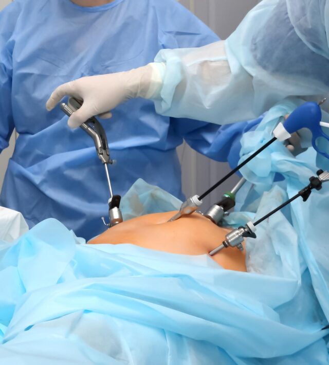 Laparoscopy