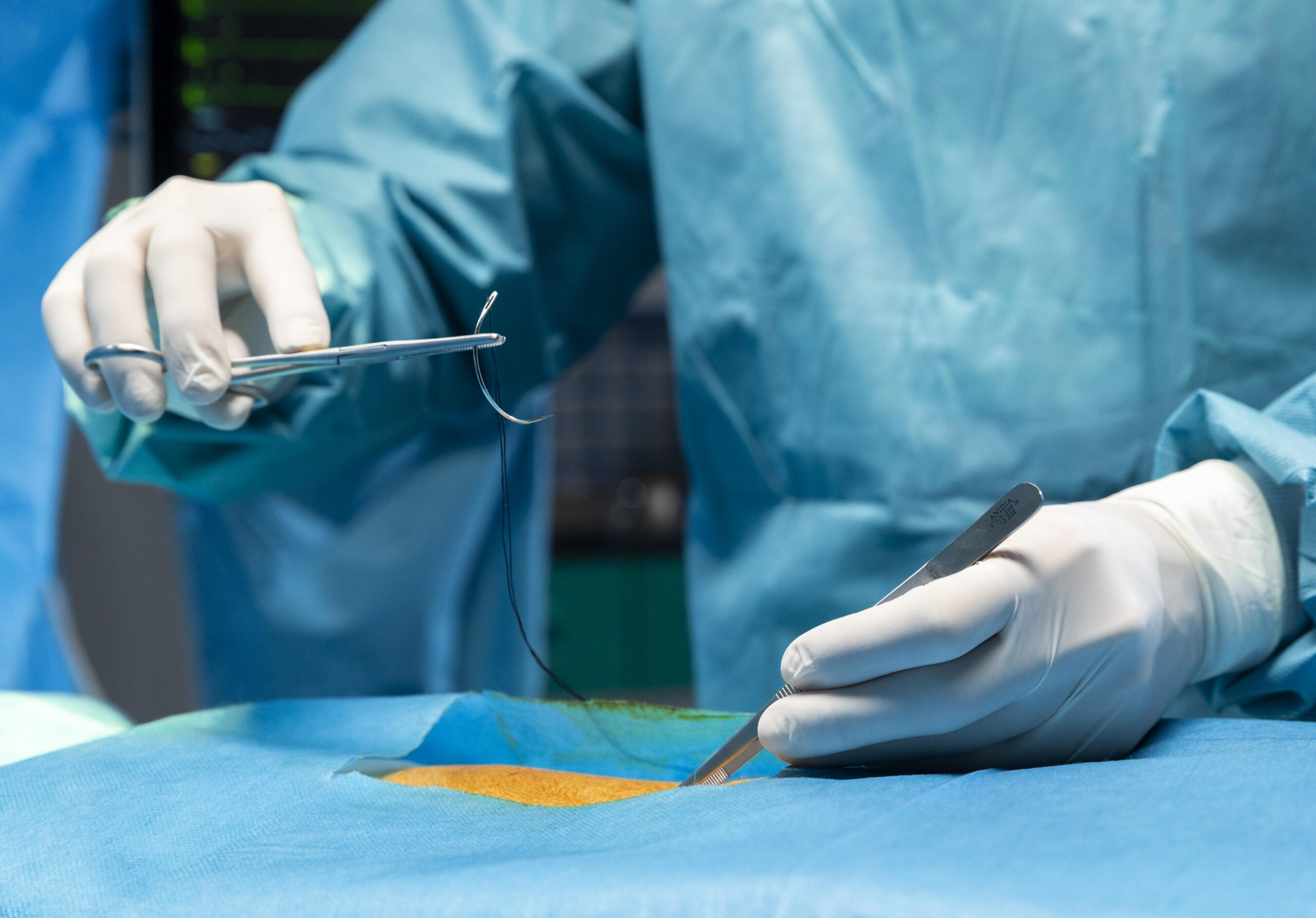 surgical method of birth control