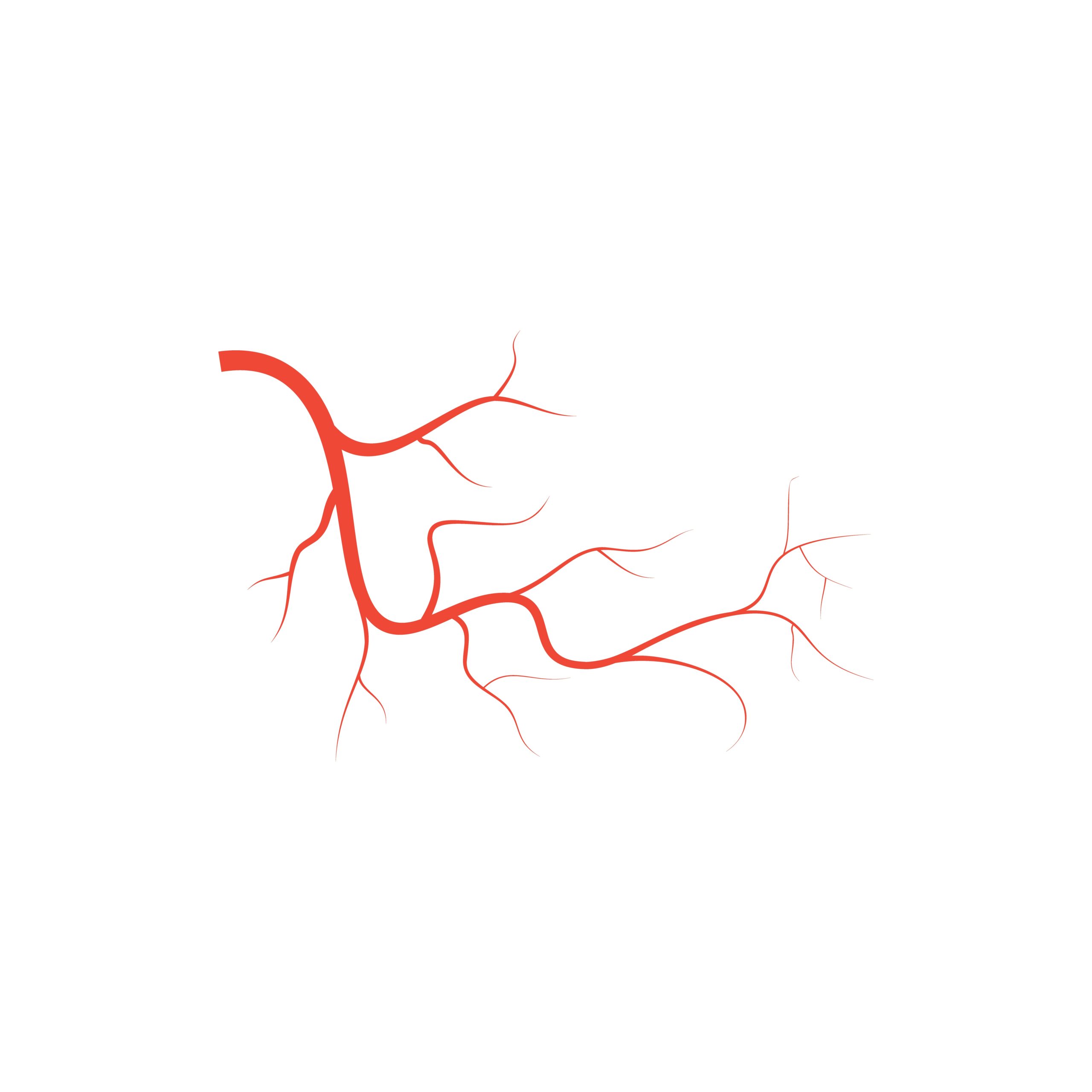 best laser angioplasty hospital in Kerala